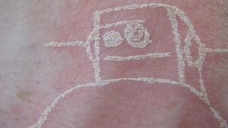 Guy Uses Laser-Etch Machine to Tattoo Himself (Verdict: Flaming Nutcase)